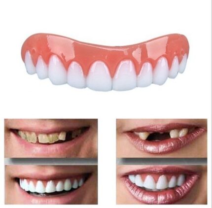Prothèses dentaires en silicone